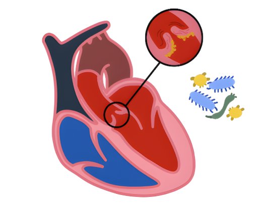 Новый калькулятор «Модифицированные критерии Дьюка»